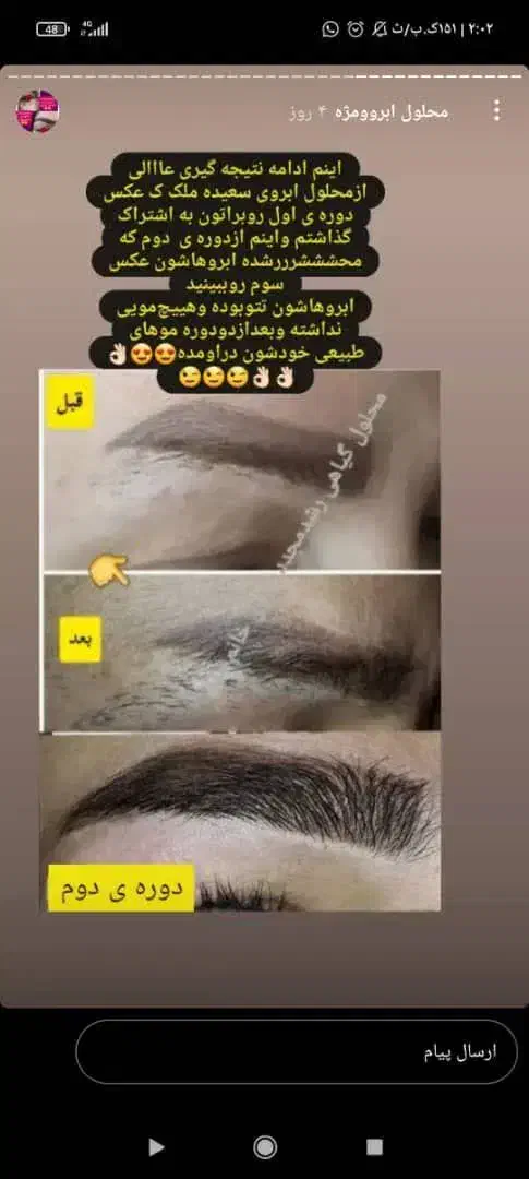 محلول رویش و رشد مجدد ابرو و مژه|آرایشی، بهداشتی، درمانی|مشهد, موسوی قوچانی|دیوار