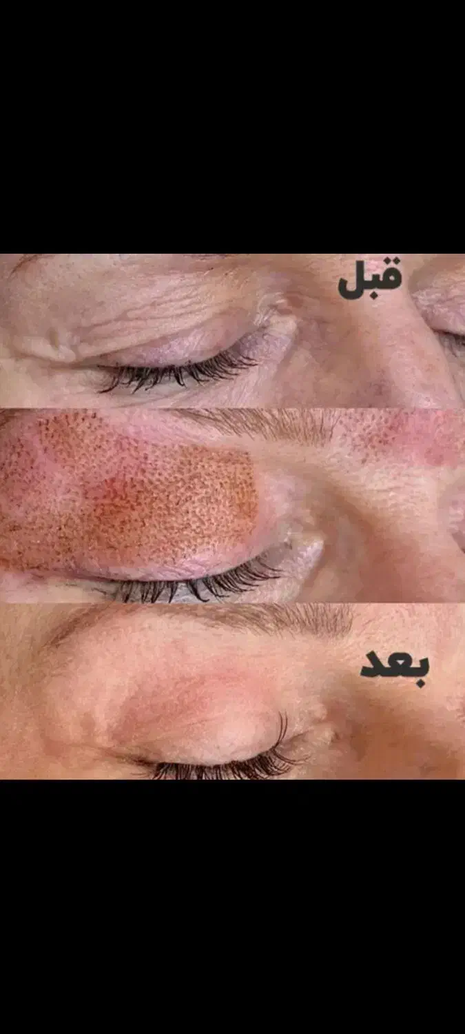 پزشکی آف ویژه|خدمات آرایشگری و زیبایی|بروجرد, |دیوار