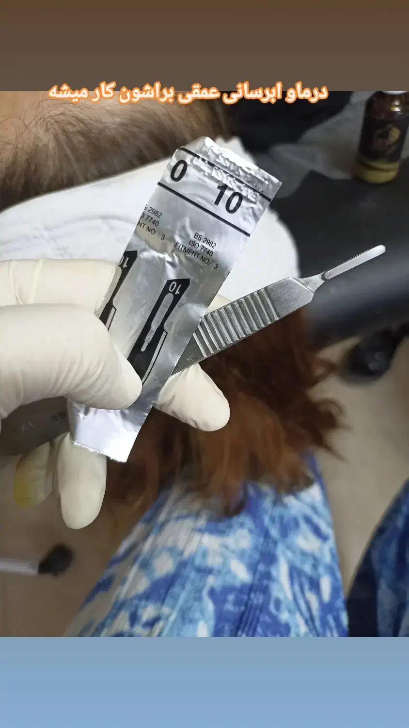 پا.کساز.ی عمقی وتخصصی فقط ۴۰۰|آرایشی، بهداشتی، درمانی|سنندج, |دیوار