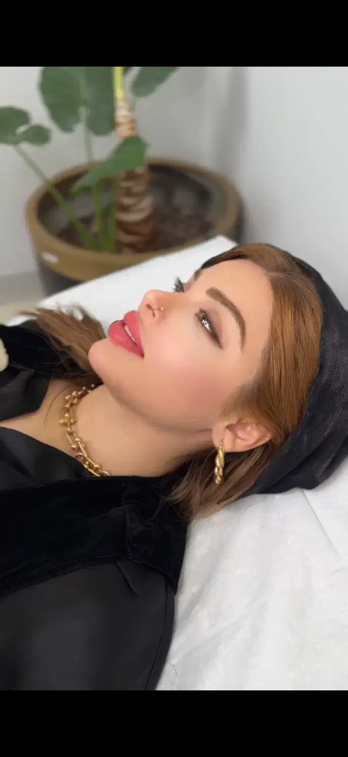 وی لاین تکنیک انحصاری کیلینیک مهرزاد ساکشن غبغب|خدمات آرایشگری و زیبایی|تهران, الهیه|دیوار