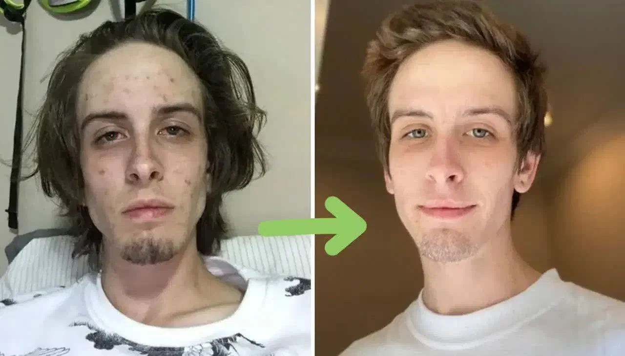 بدون درد و خماری در محل کارت ترک کن|خدمات آرایشگری و زیبایی|زنجان, |دیوار