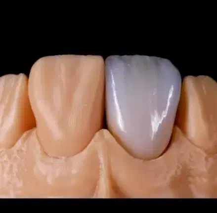 جذب کارآموز پرسلن گذاری لابراتوار دندانسازی|استخدام درمانی، زیبایی، بهداشتی|بوشهر, |دیوار