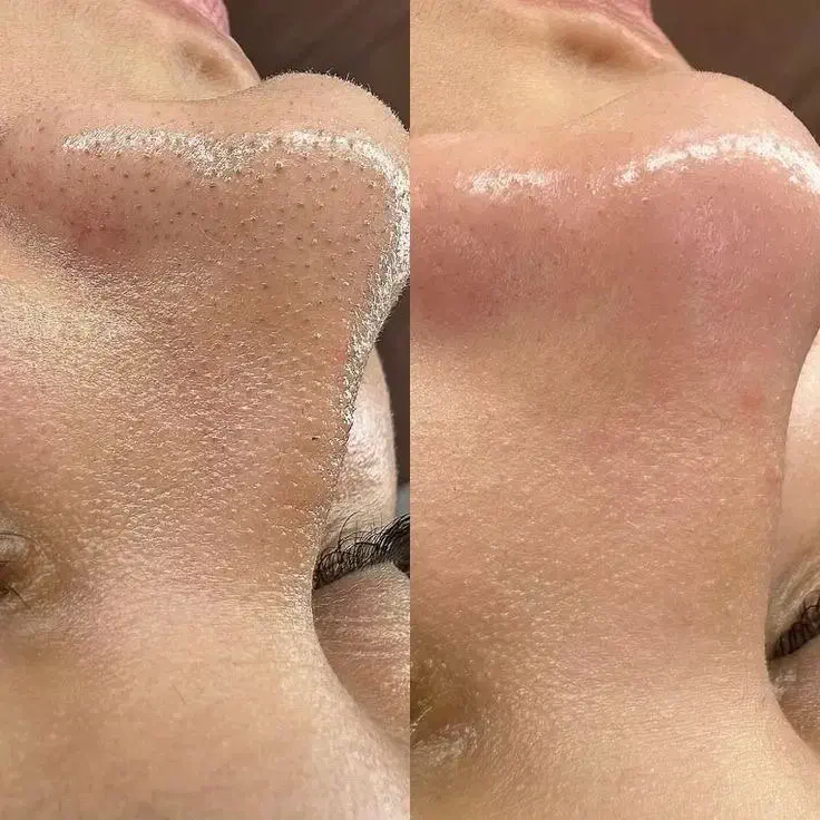 مرکز تخصصی پاکسازی صورت|خدمات آرایشگری و زیبایی|جم, |دیوار