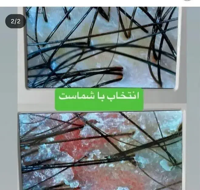 یلدایی کراتین ،ناخن ،فیشیال ،اسکالپ ،رنگ و دکلره|خدمات آرایشگری و زیبایی|کرمان, |دیوار