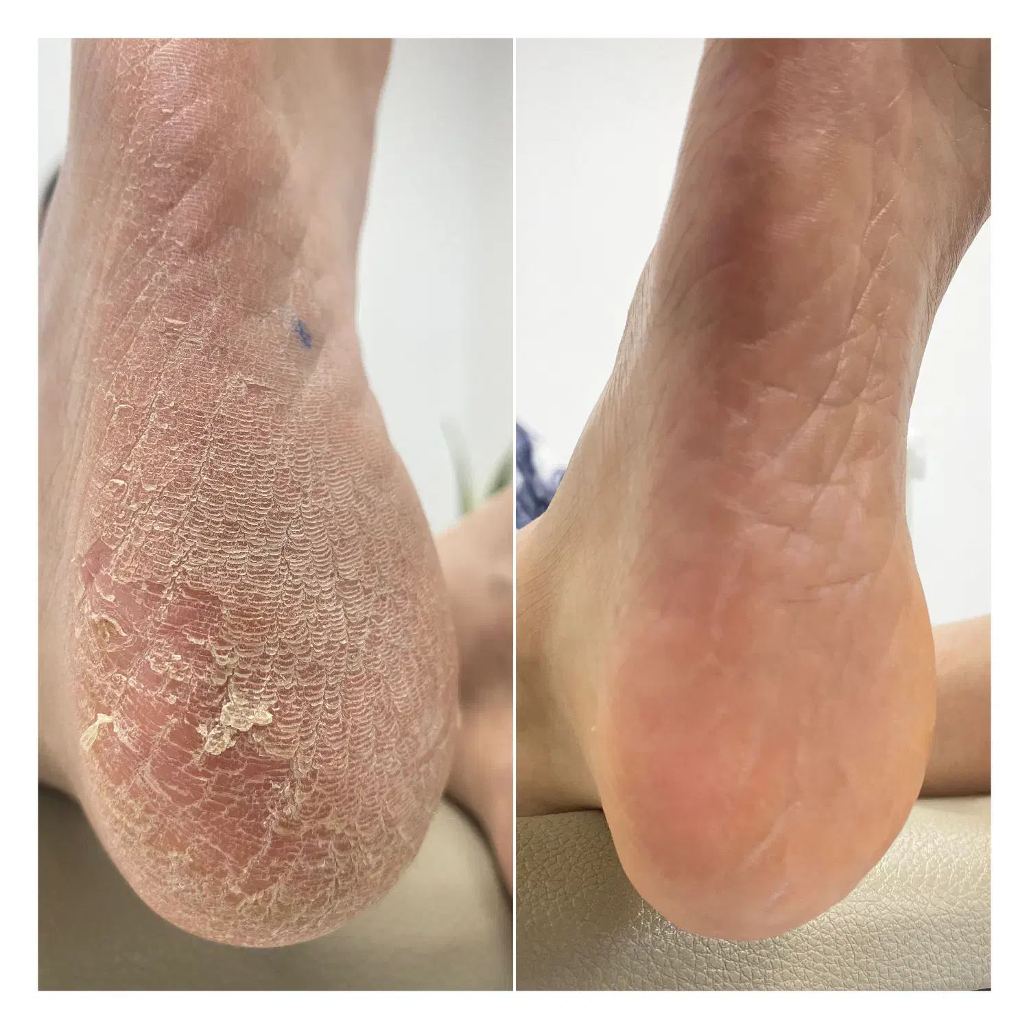 پدیکور درمانی و ریلکسی|خدمات آرایشگری و زیبایی|قائم‌شهر, |دیوار