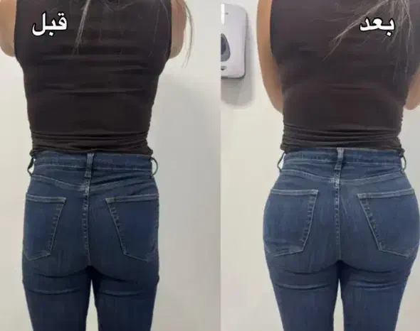 آموزش و خدمات فیلر بادی باسن بیکینی دست و پا|خدمات آرایشگری و زیبایی|قم, زنبیل آباد|دیوار