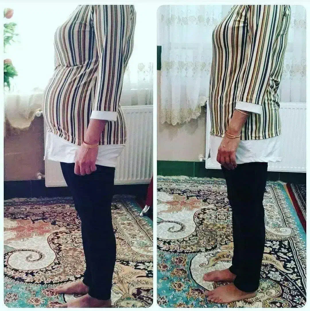 چربی سوز قوی گیاهی|عمدهفروشی|اهواز, سپیدار|دیوار