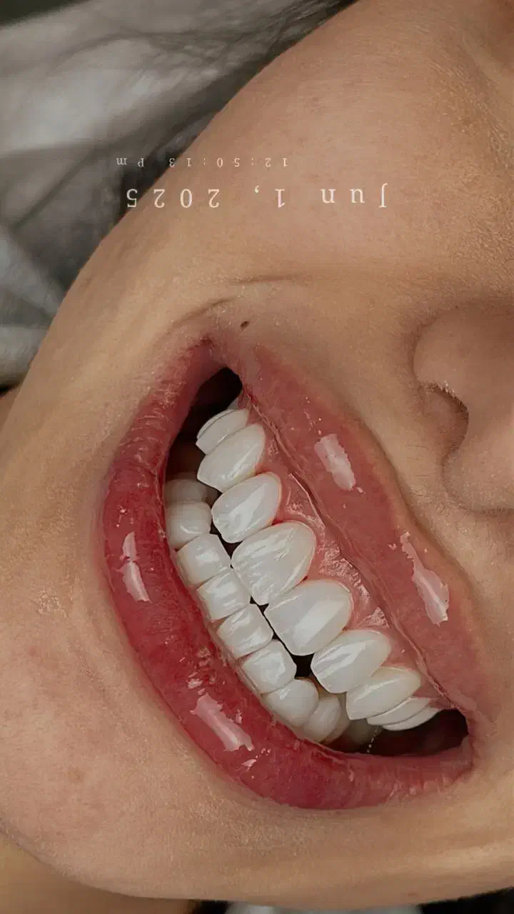 جشنواره بمناسبت روز مادر ایمپلنت، عصب کشی، جراحی،|خدمات آرایشگری و زیبایی|مشهد, شریف|دیوار