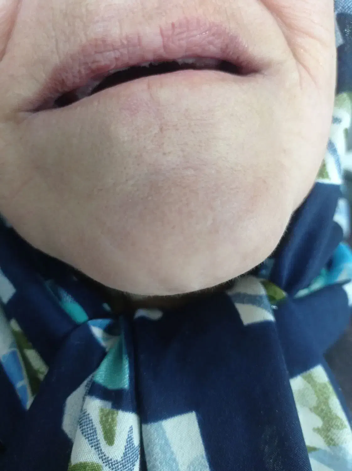 دندان مصنوعی لمینتی طرح لبخند|خدمات آرایشگری و زیبایی|محمدیه-قزوین, |دیوار