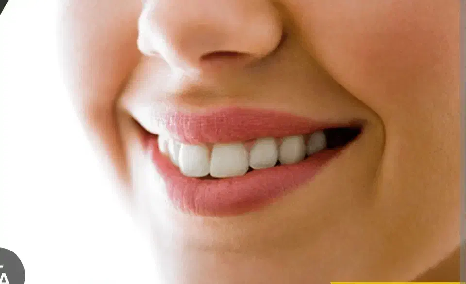 جراحی دندان عقل، عصب کشی، ارتودنسی|خدمات آرایشگری و زیبایی|زنجان, |دیوار