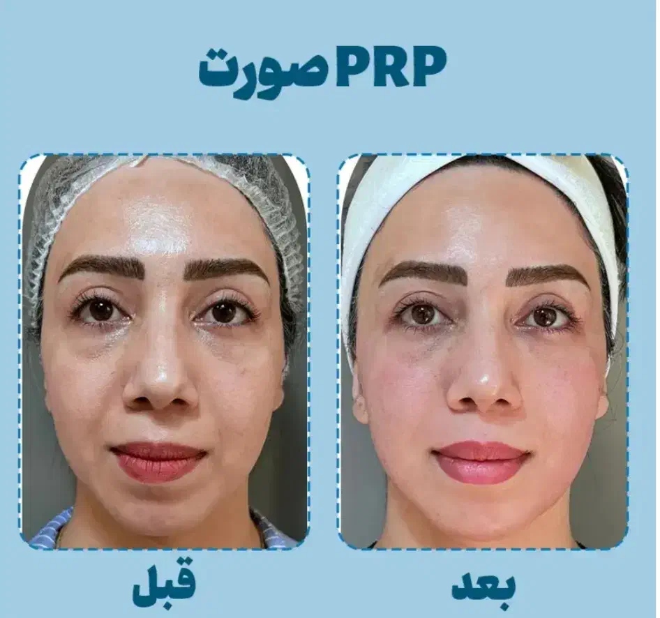 خدمات زیبایی|خدمات آرایشگری و زیبایی|دورود, |دیوار