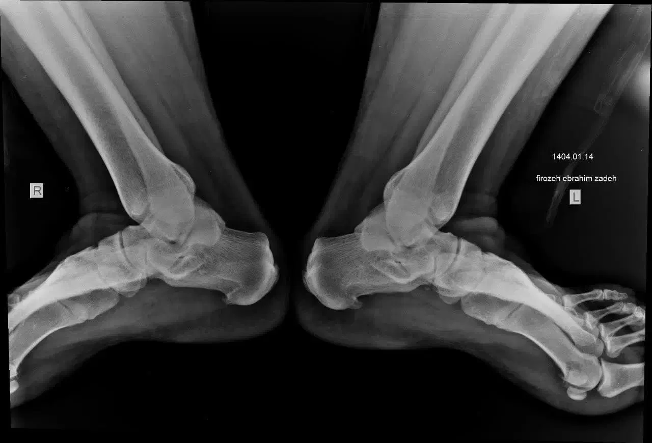 رادیولوژی در منزل|خدمات آرایشگری و زیبایی|قم, سالاریه|دیوار