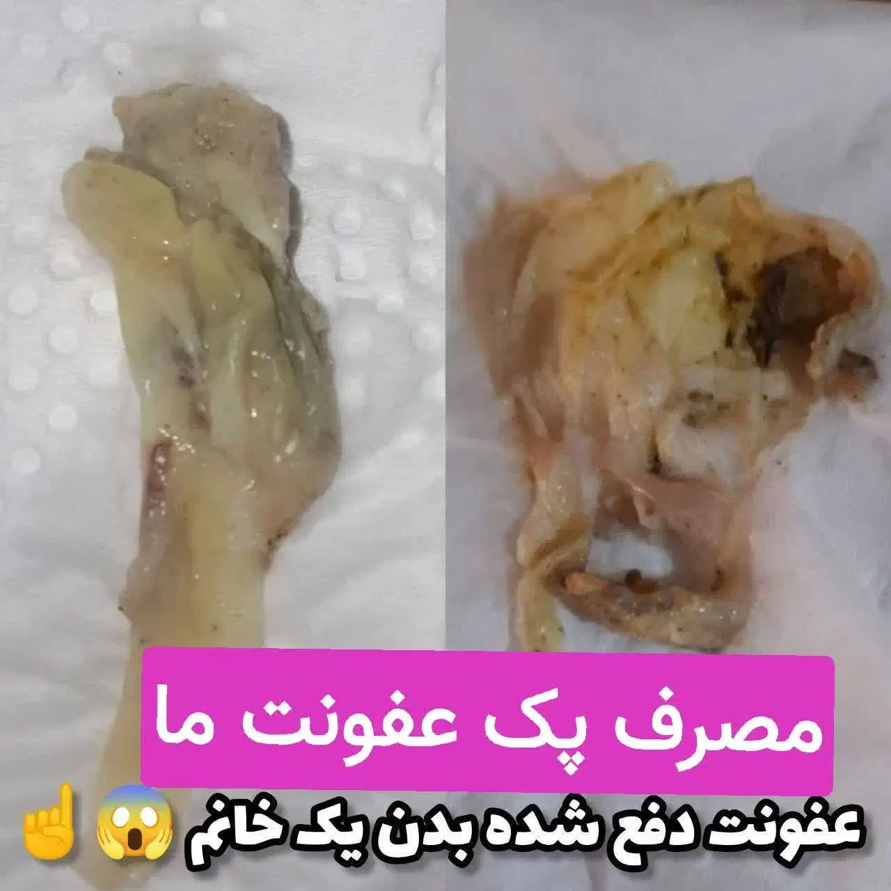 بارداری شیرین بعداز پاکسازی|خدمات آرایشگری و زیبایی|کوهدشت, |دیوار