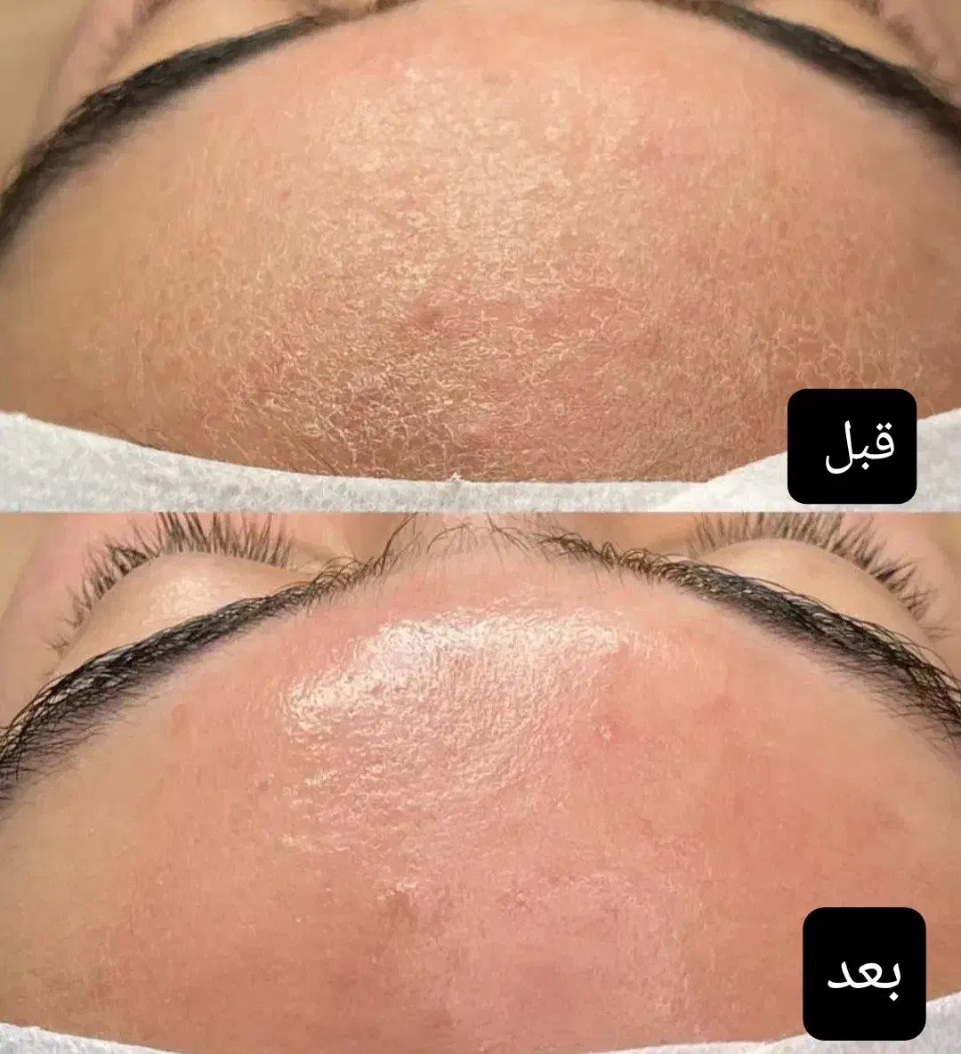 تخفیفات ویژه فیشال های تخصصی ، فقط ب مدت یک هفته|خدمات آرایشگری و زیبایی|ایرانشهر, |دیوار