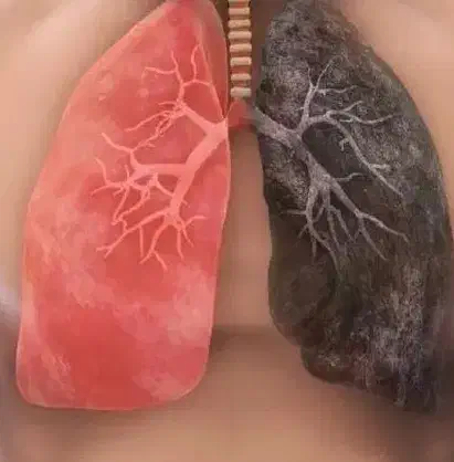 بهبود مشکلات ریوی و تنفسی|آرایشی، بهداشتی، درمانی|گنبد کاووس, |دیوار