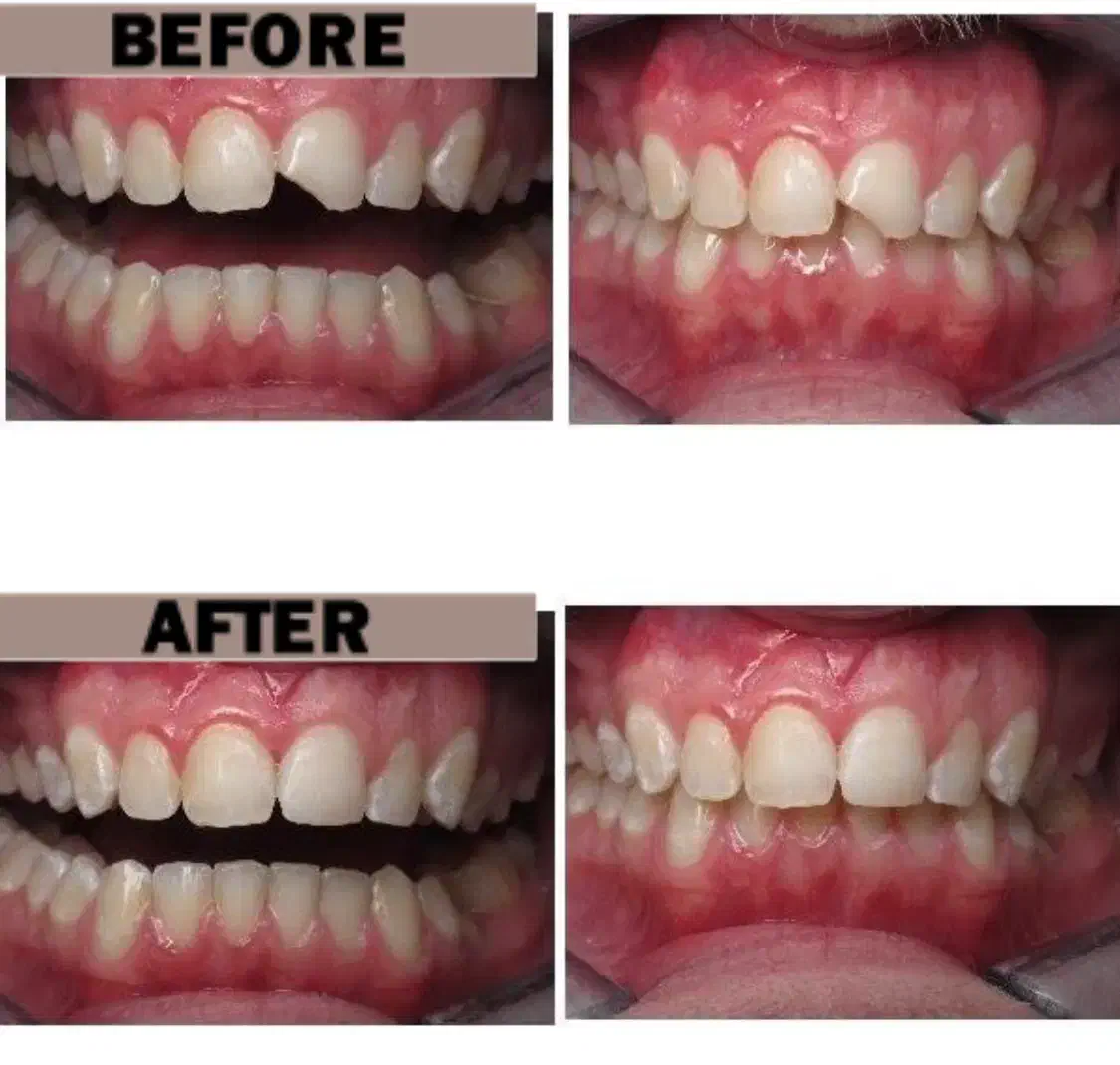 خدمات دندانپزشکی تاکستان ( آفر ویژه )|خدمات آرایشگری و زیبایی|تاکستان, |دیوار