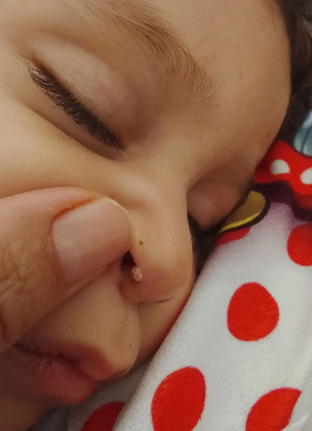 حذف خال ،زگیل فقط با قطره|خدمات آرایشگری و زیبایی|سبزوار, غرب نیروگاه|دیوار