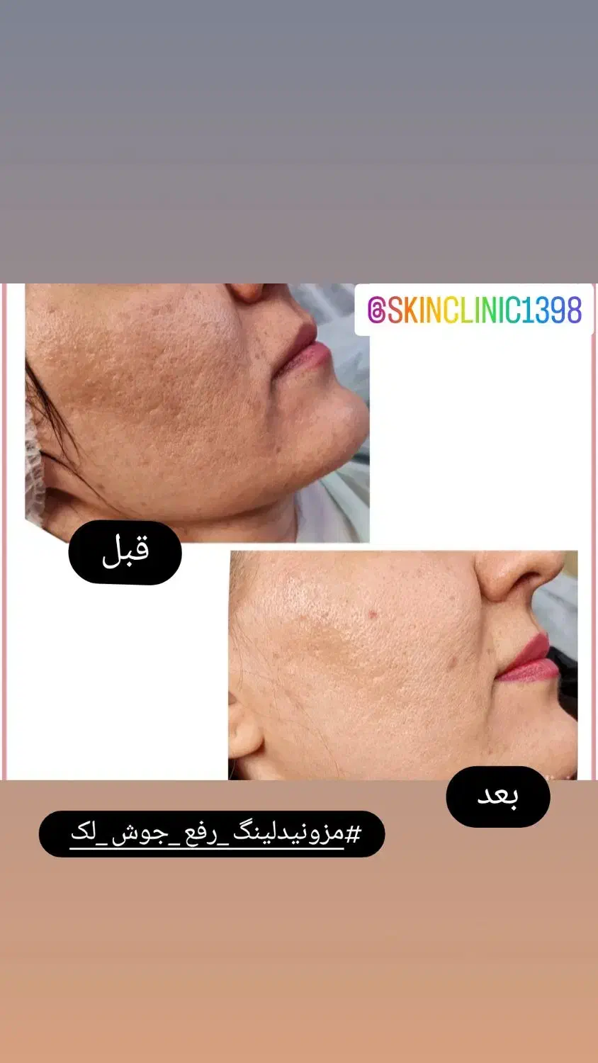 کلینیک پوست و مو|خدمات آرایشگری و زیبایی|تهران, خانی آباد نو شمالی|دیوار