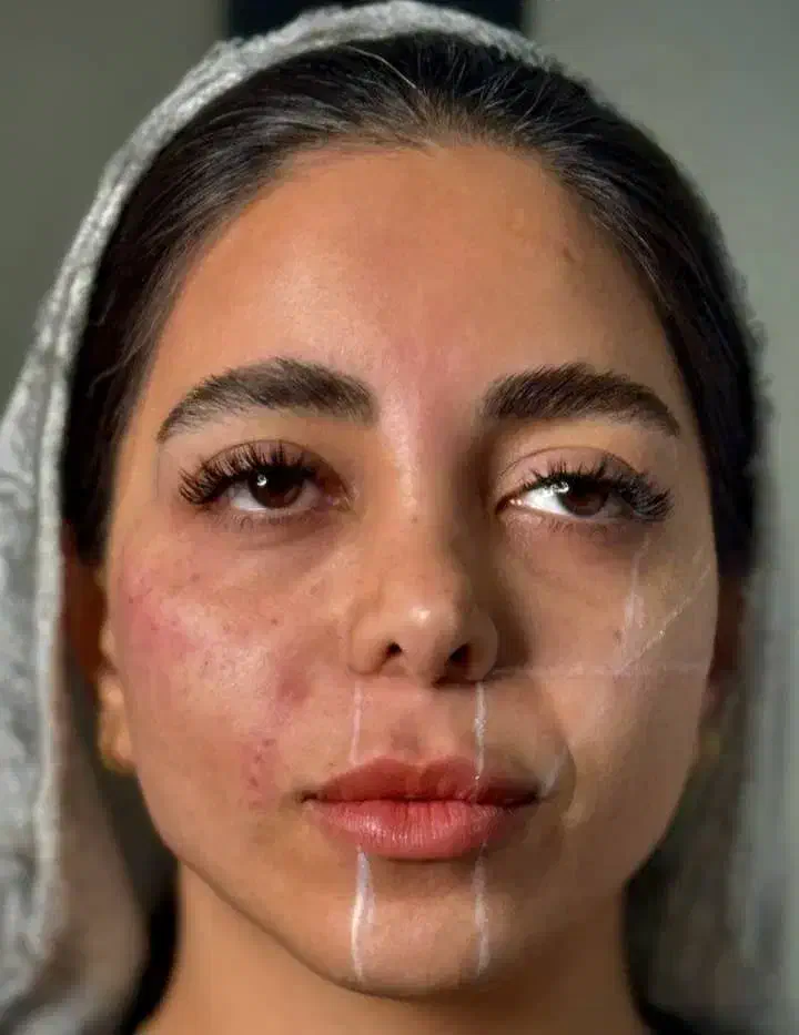مادلینگ صورت به سلیقه توزیبایی را تجربه کنید.|خدمات آرایشگری و زیبایی|قم, سالاریه|دیوار