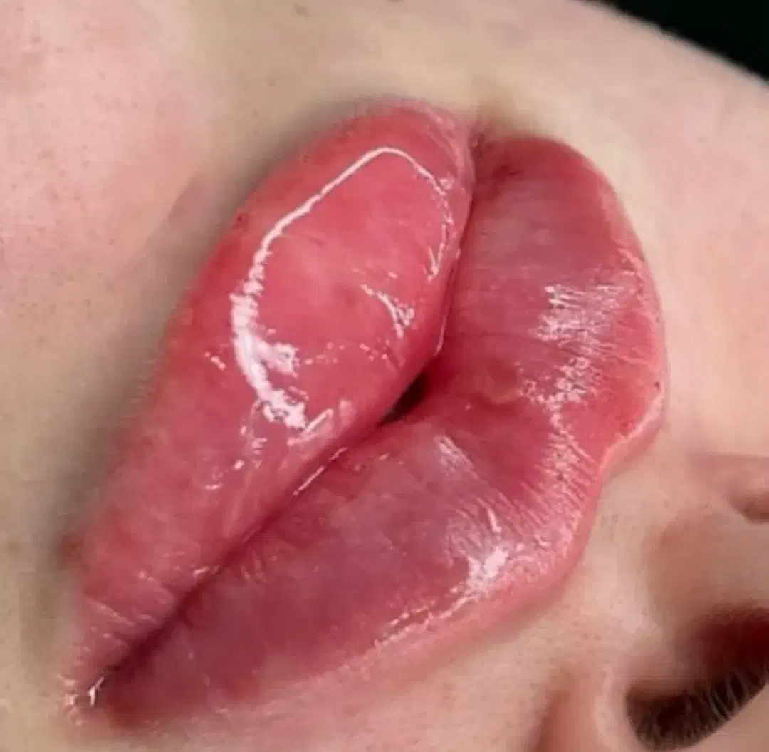 تزریق ژل وبوتاکس|خدمات آرایشگری و زیبایی|ساوه, |دیوار