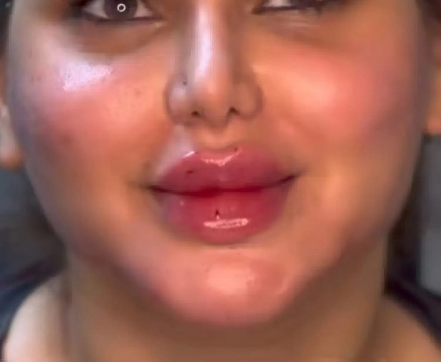 آف ژل وبوتاکس|خدمات آرایشگری و زیبایی|مسجد سلیمان, |دیوار