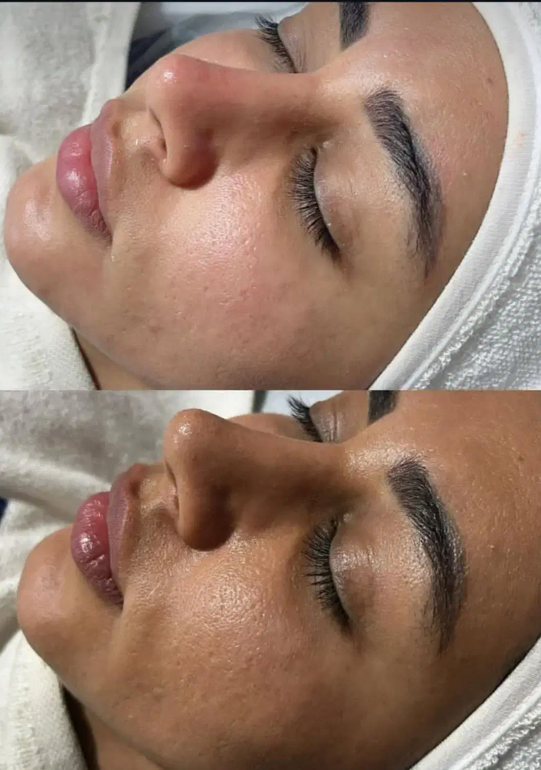 جشنواره فیشال وپاکسازی پوست خانمها واقایان|خدمات آرایشگری و زیبایی|همدان, |دیوار