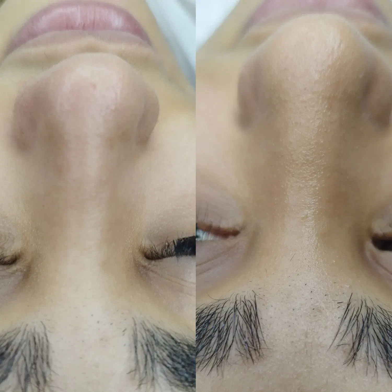 فیشیال تخصصی وپاکسازی پوست|خدمات آرایشگری و زیبایی|بندر کنگان, |دیوار