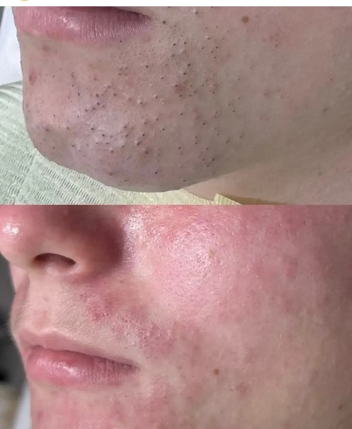 تخفیف ویژه برای یلدا،فشیال و موزو و میکرو و لیفت|خدمات آرایشگری و زیبایی|تهران, تهرانپارس جنوبی|دیوار