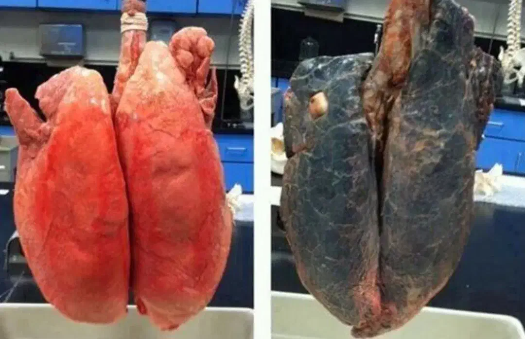 ترک سیگار در ۲ روز|خدمات آرایشگری و زیبایی|یاسوج, |دیوار