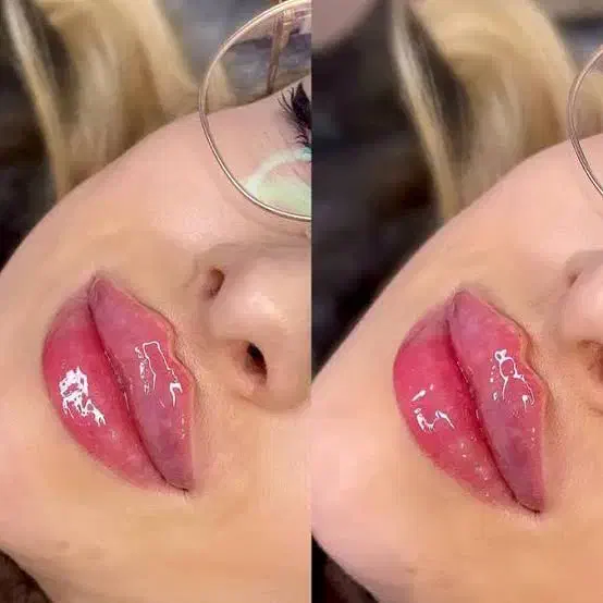 مدل رایگان ژل و فیلر|خدمات آرایشگری و زیبایی|اسلامشهر, مطهری|دیوار