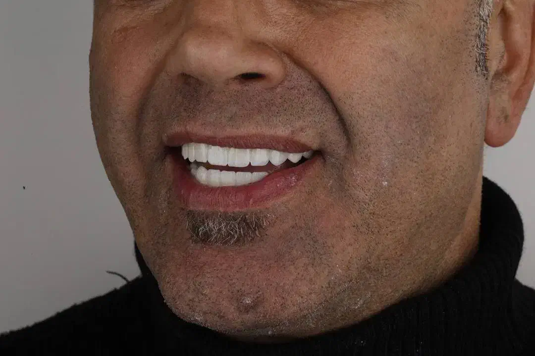 استخدام منشی تلفنی برای کالسنتر دندانپزشکی|استخدام بازاریابی و فروش|تهران, فلسطین (میدان انقلاب)|دیوار