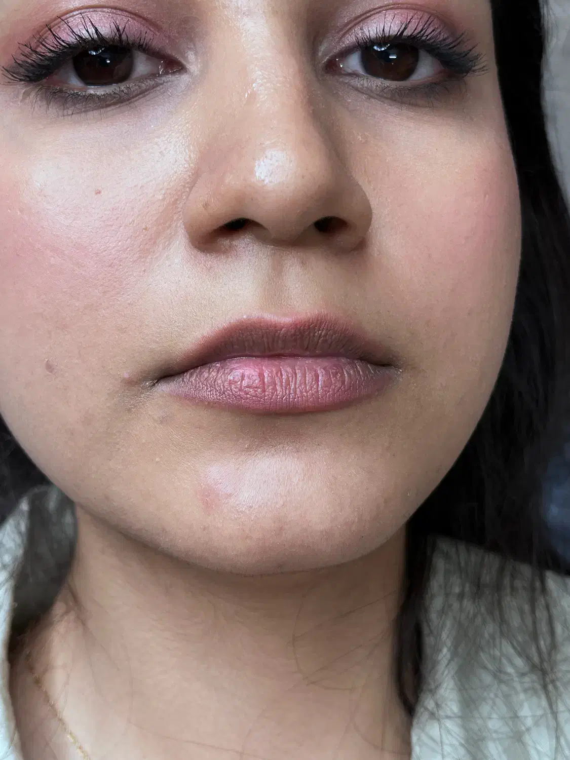 ژل و بوتاکس|خدمات آرایشگری و زیبایی|قاسم‌آباد (خواف), |دیوار