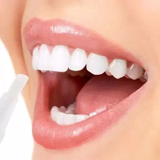 قلم سفید کننده دندان /لمینت/زیبایی/کامپوزیت|خدمات آرایشگری و زیبایی|ایلام, |دیوار