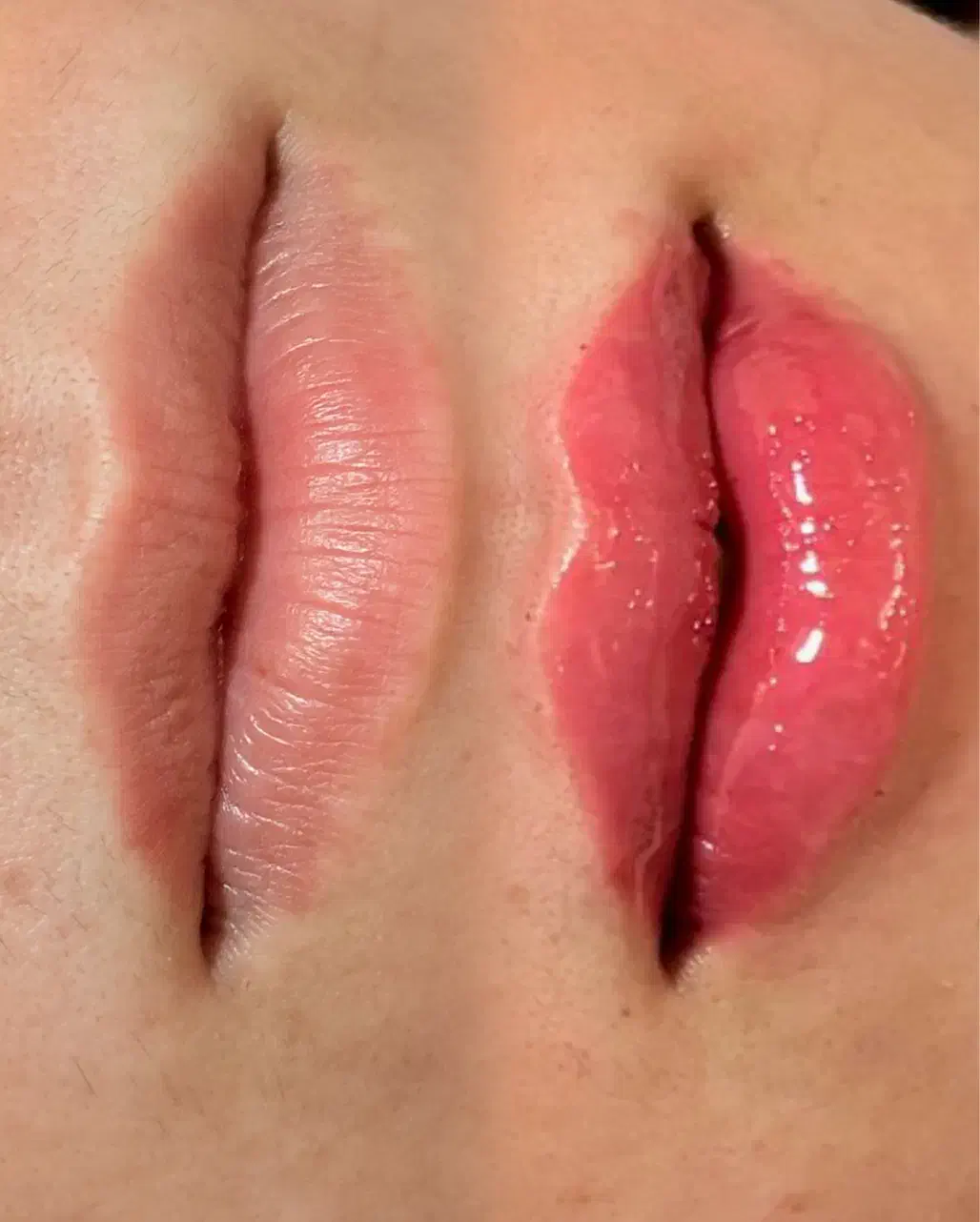 تخفیف ویژه ژل و بوتاکس|خدمات آرایشگری و زیبایی|گنبد کاووس, |دیوار