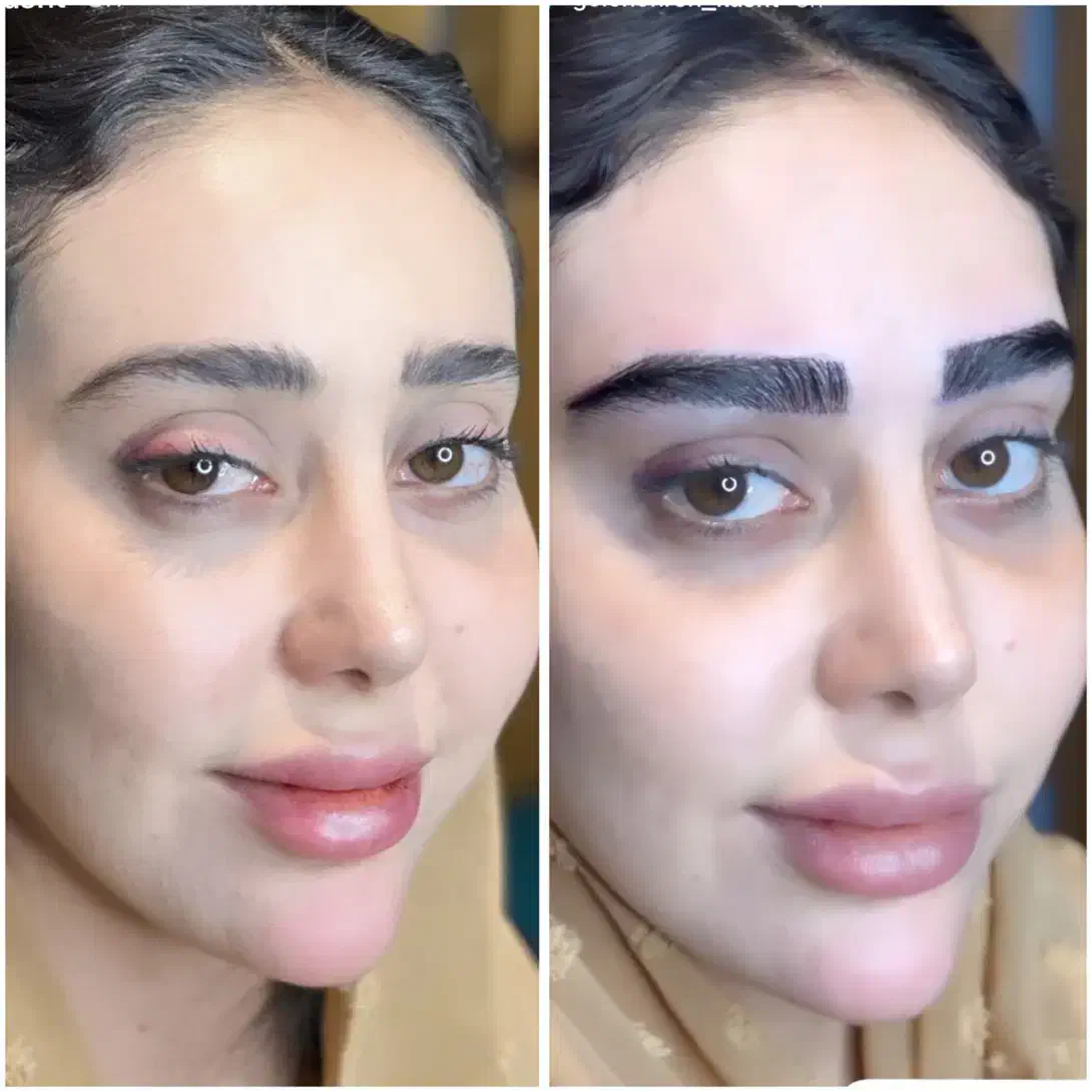 کاشت تخصصی مو و ابرو دائم|خدمات آرایشگری و زیبایی|مشهد, کلاهدوز|دیوار