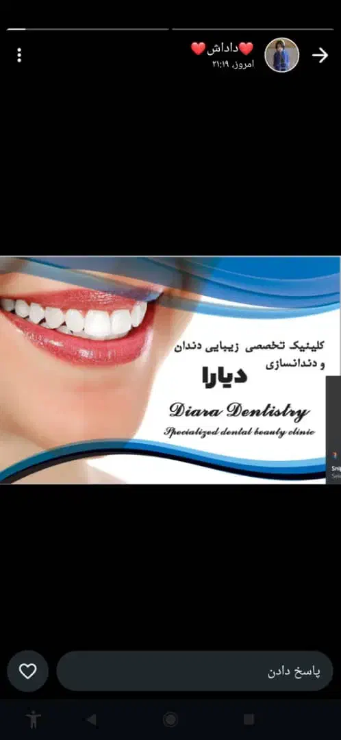 کامپوزیت ،پرکردن دندان ،ترمیم دندانهای پوسیده|خدمات آرایشگری و زیبایی|یاسوج, |دیوار