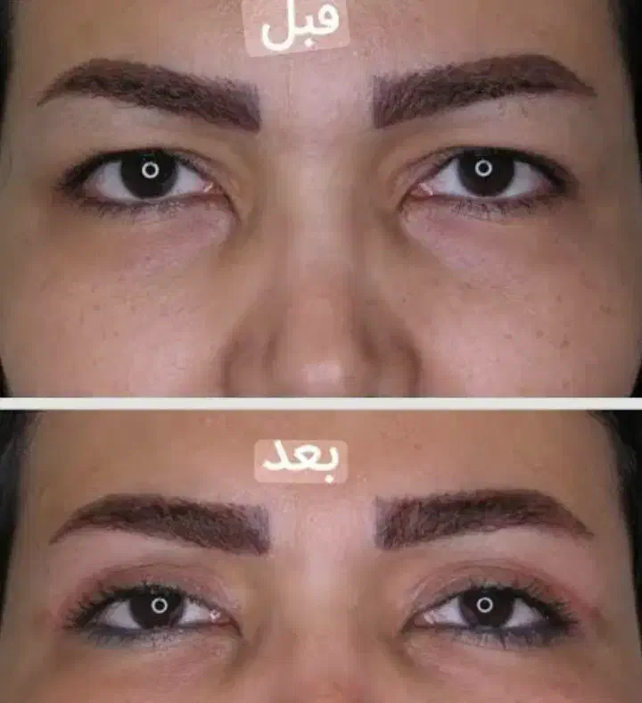 خدمات زیبایی و جوانسازی|خدمات آرایشگری و زیبایی|کرمانشاه, |دیوار