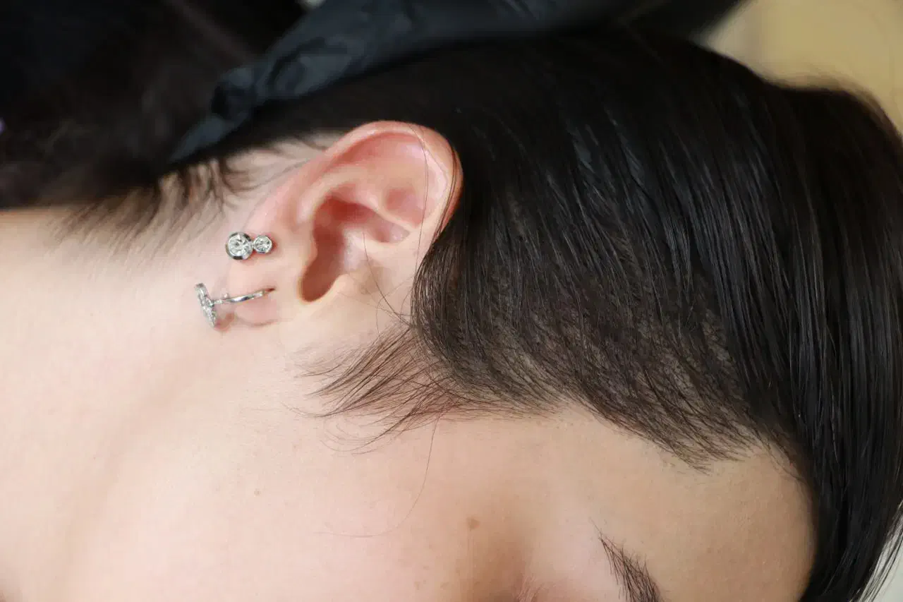 رفع کم پشتی مو با میکرو اسکالپ سر|خدمات آرایشگری و زیبایی|نسیم‌شهر, |دیوار