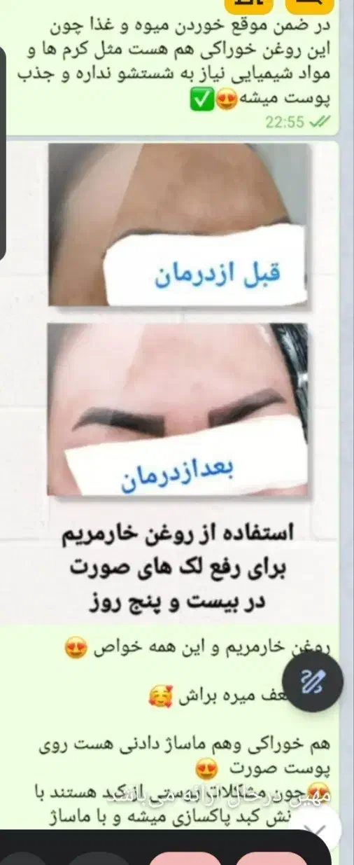 روغن درمانی|خوردنی و آشامیدنی|اسلامشهر, ده عباس|دیوار