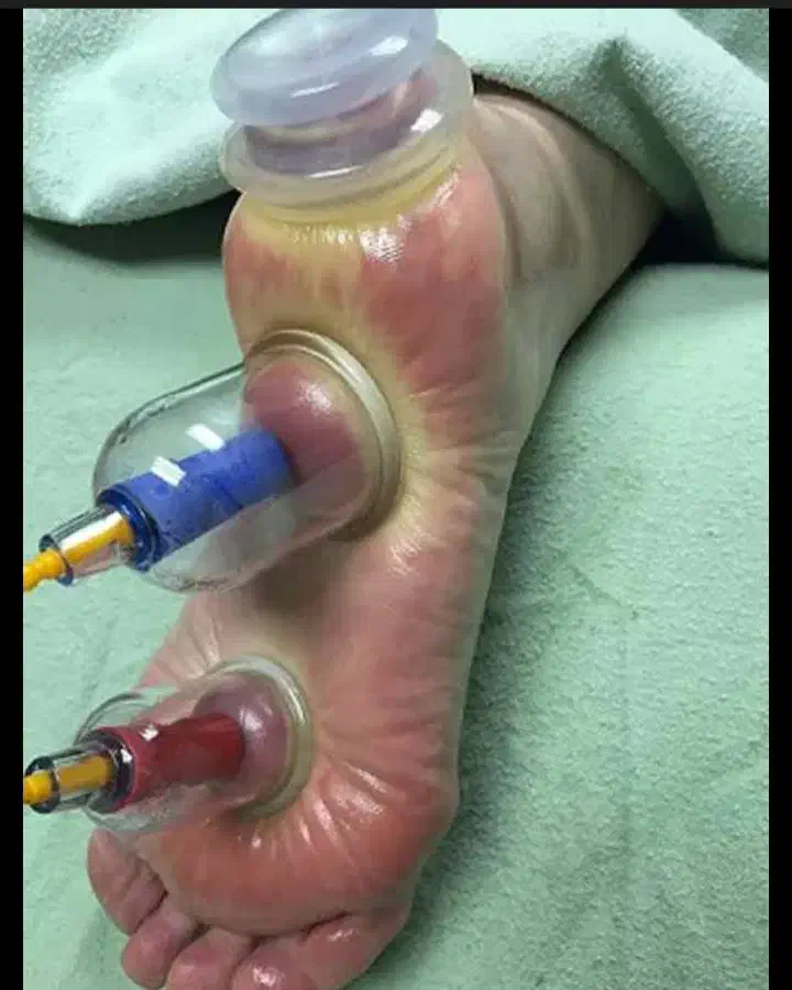 آموزش حجامت وزالودرمانی|خدمات آموزشی|تربت‌حیدریه, کوه سنگی|دیوار