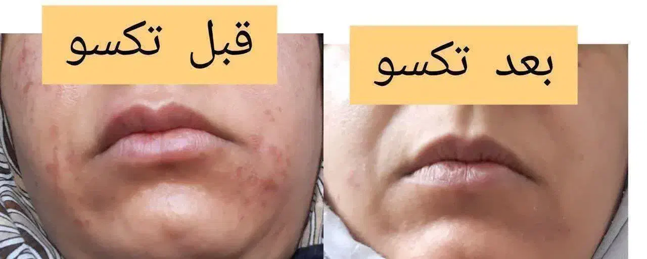 زیبایی پوست و مو|آرایشی، بهداشتی، درمانی|سنندج, |دیوار