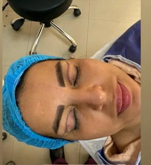 بلفاروپلاستی،لیفت ابرو،لیفت شقیقه،دایرکت ابرو|خدمات آرایشگری و زیبایی|ارومیه, |دیوار