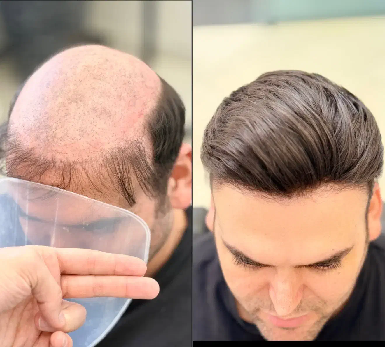 ترمیم مو|آرایشگاه و سالن‌های زیبایی|کرج, عظیمیه|دیوار