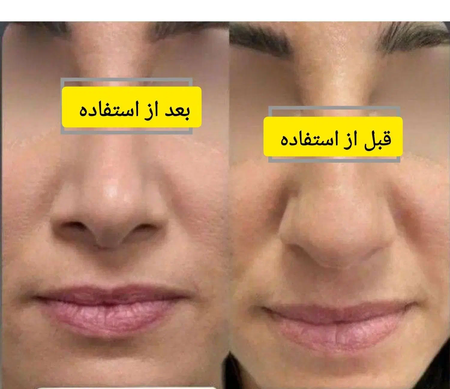 کرم سفید کننده صورت وبدن 10درجه سفیدی بدون بازگشت|آرایشی، بهداشتی، درمانی|کرمان, |دیوار