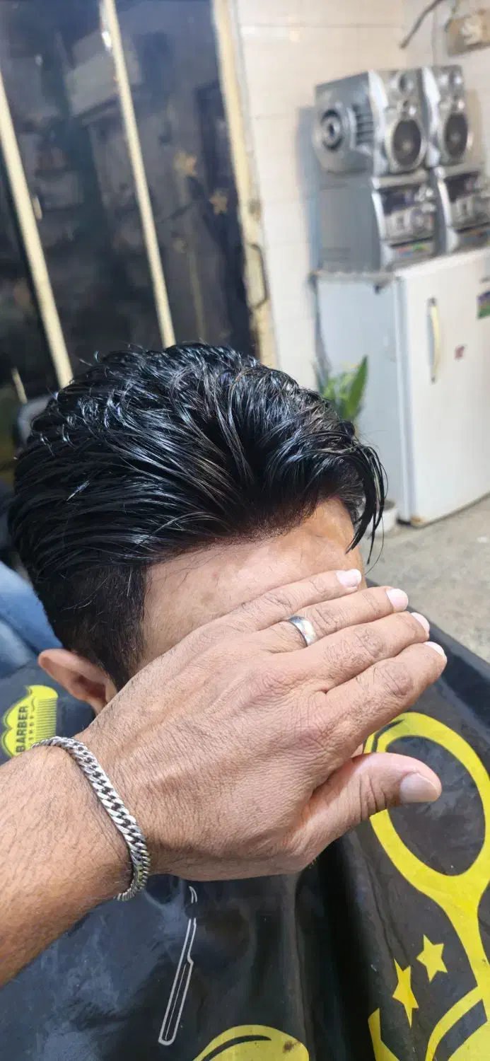 پروتز مو|خدمات آرایشگری و زیبایی|دزفول, |دیوار