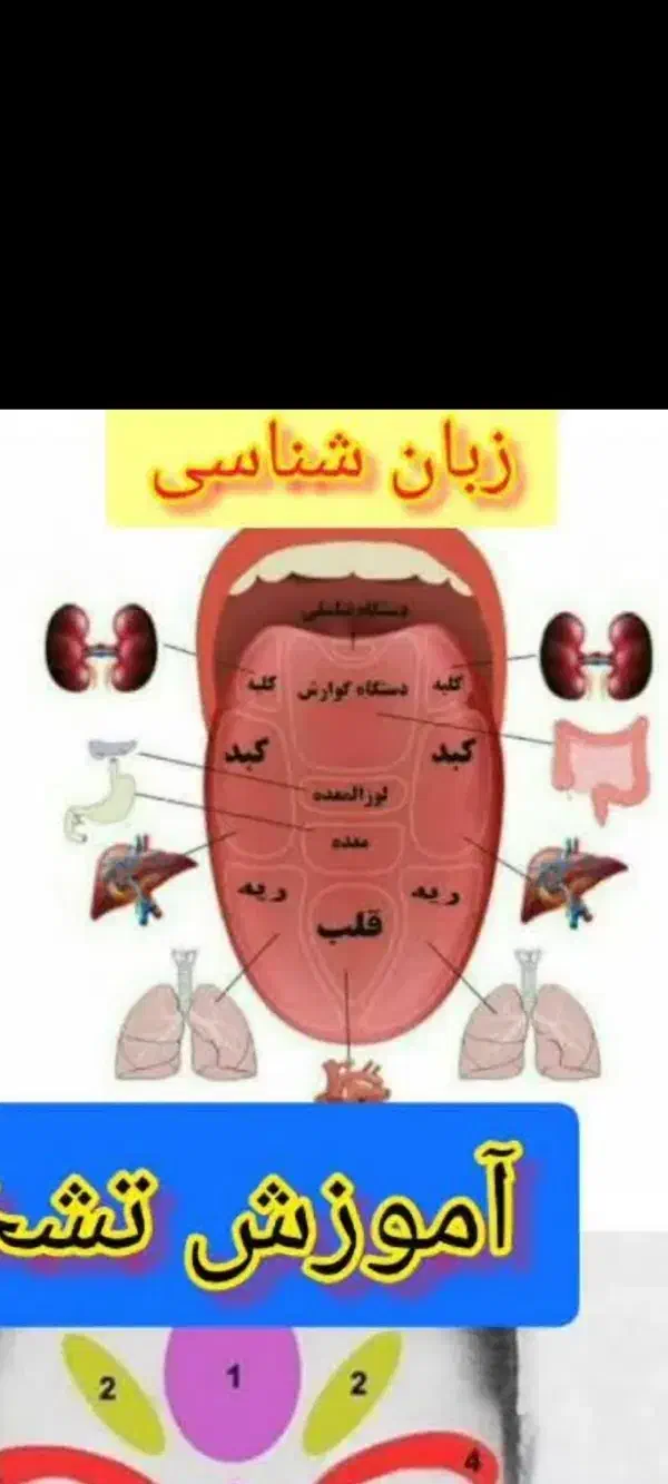 آموزش تشخیص بیماریها از روی زبان ودرمان آنها|خدمات آموزشی|میاندوآب, |دیوار