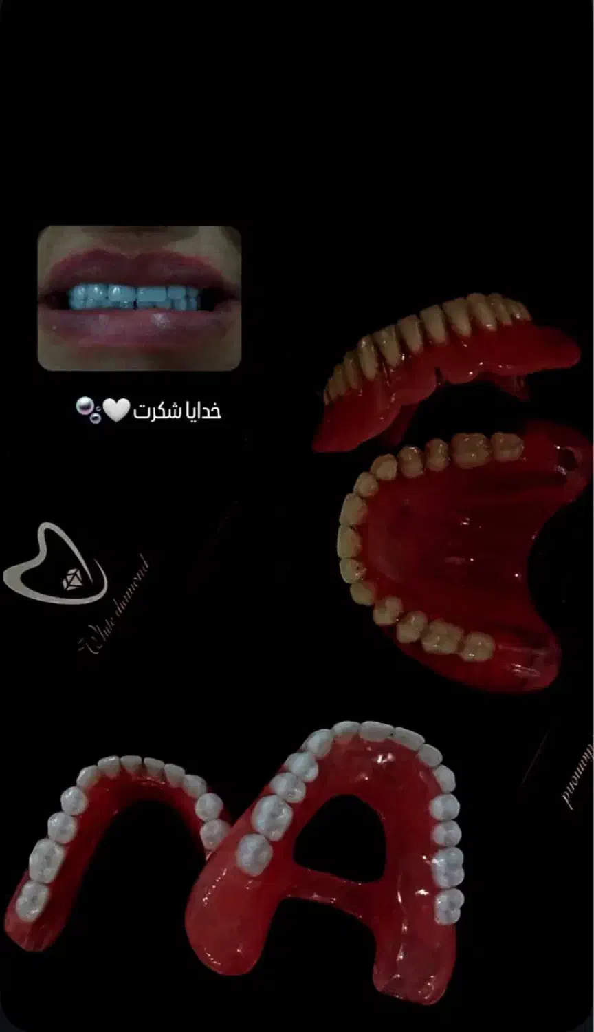 ساخت دندان مصنوعی|خدمات آرایشگری و زیبایی|اردبیل, |دیوار