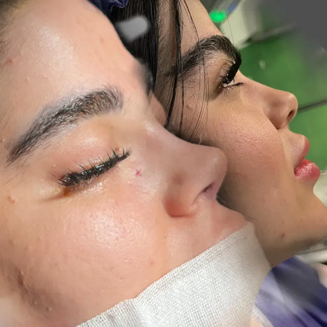 جراحی بینی10تومن نقد مابقی ماهی 2 تومن|خدمات آرایشگری و زیبایی|تهران, یوسفآباد|دیوار