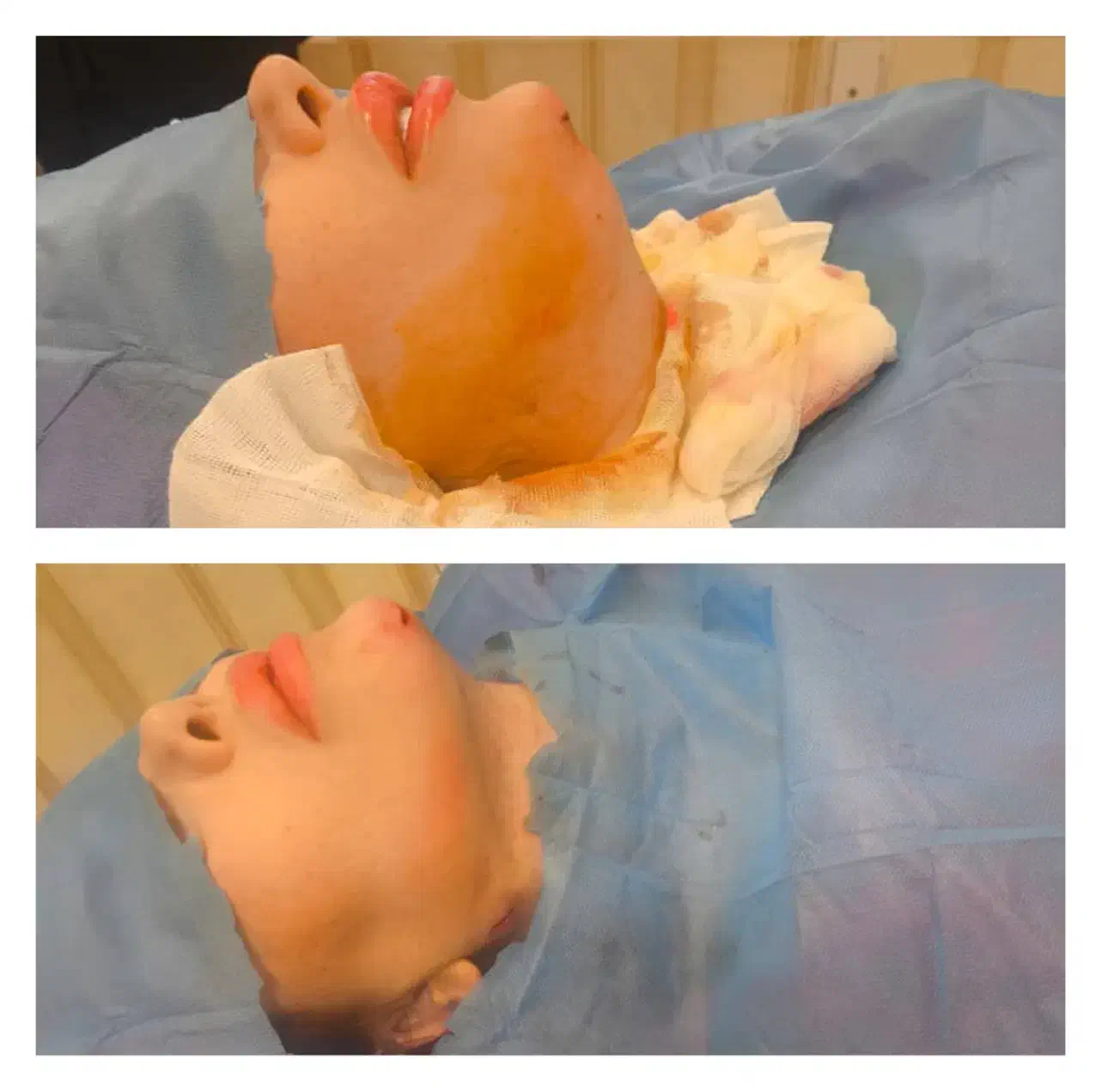 تخفیف خاص لیپوساکشن فیلر بوتاکس|خدمات آرایشگری و زیبایی|کرمانشاه, |دیوار