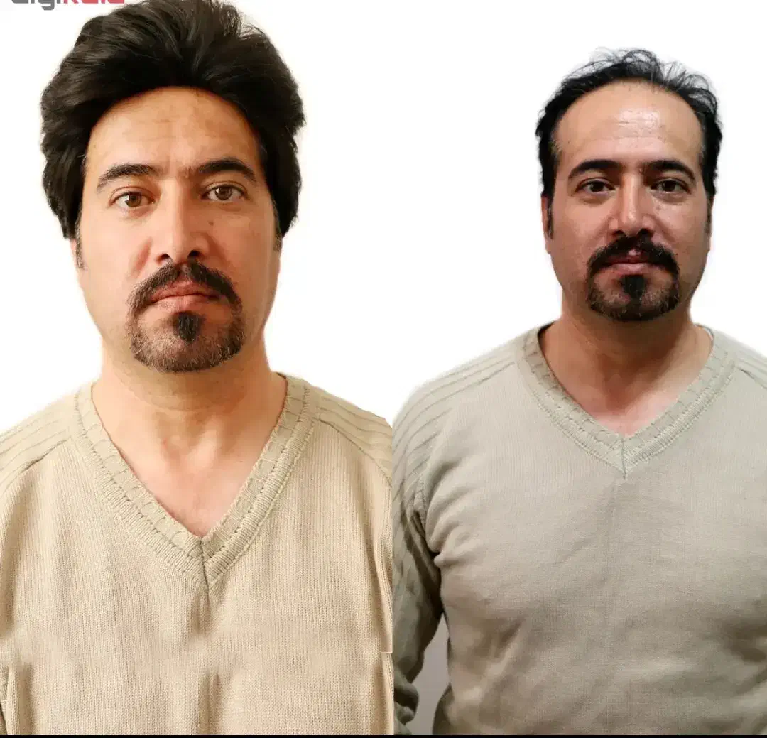 کلاه گیس مردانه|آرایشی، بهداشتی، درمانی|پارس‌آباد, |دیوار